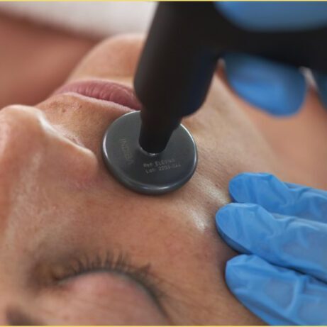 Lovital Fisioterapia - Indiba facial Lovital Fisioterapia - Servicios, tratamiento de Indiba facial